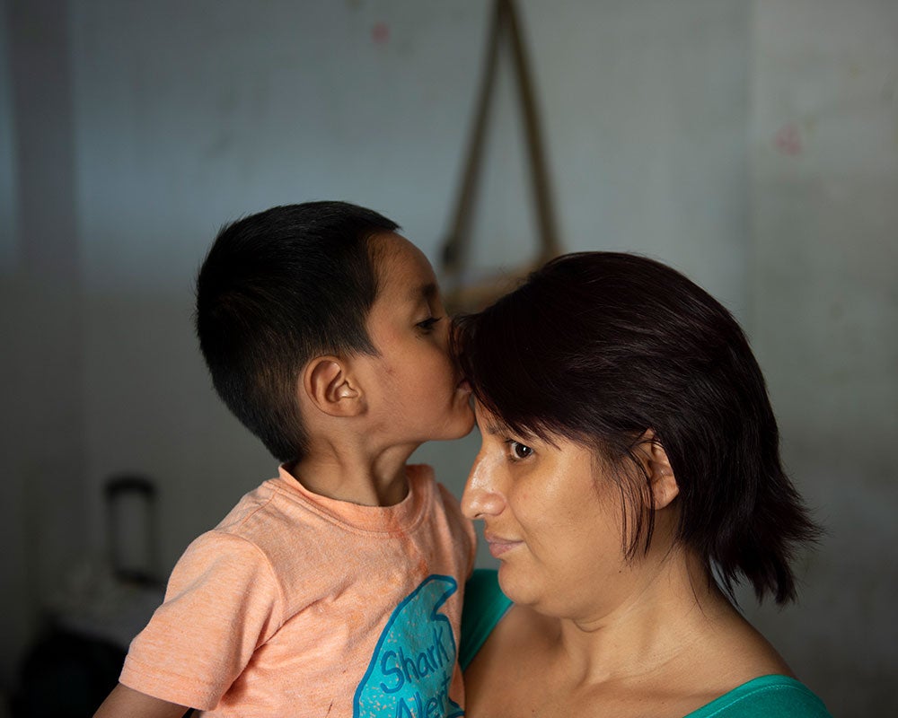 Anghelo kisses his mother after cleft surgery gallery