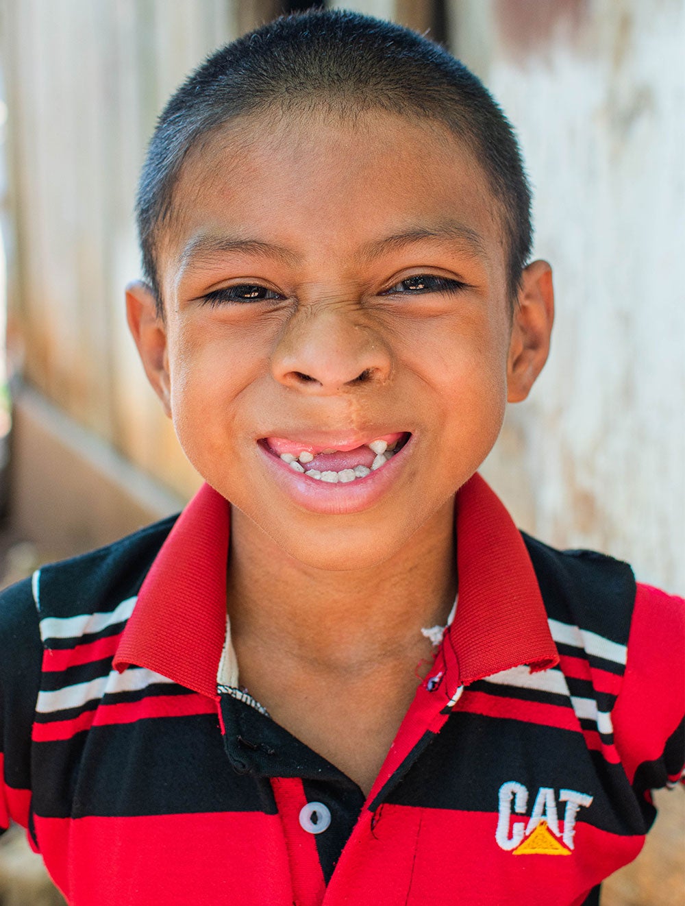 Auner and his brother play with a soccer ball after Auner's free cleft lip and palate treatment in Guatemala