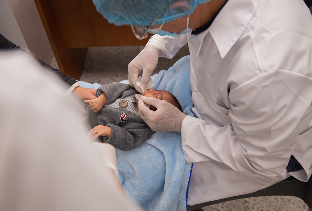 A baby with a cleft gets an impression of their mouth made at FISULAB 