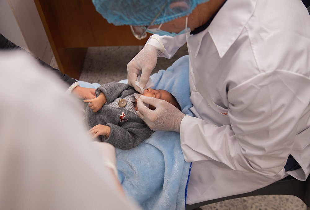 A baby with a cleft gets an impression of their mouth made at FISULAB