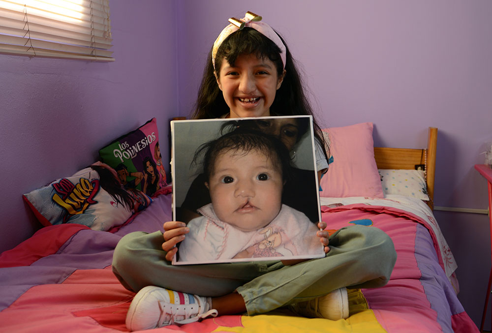 Estephany holds a picture of herself before her Smile Train-sponsored cleft surgery