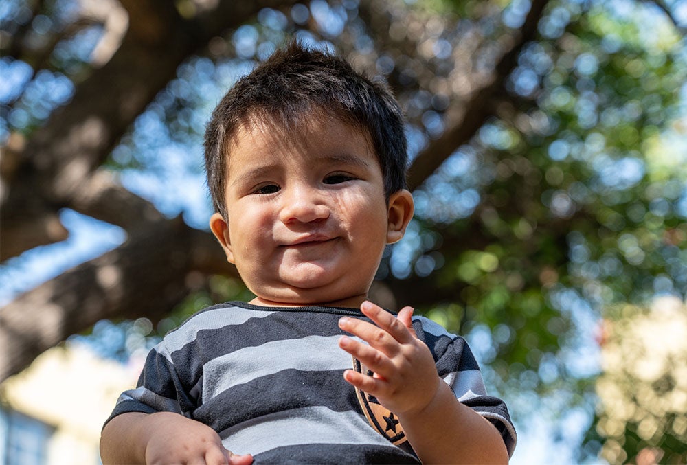 Felix olhando para baixo e sorrindo depois de sua cirurgia de lábio leporina gratuita patrocinada pela Smile Train na Argentina