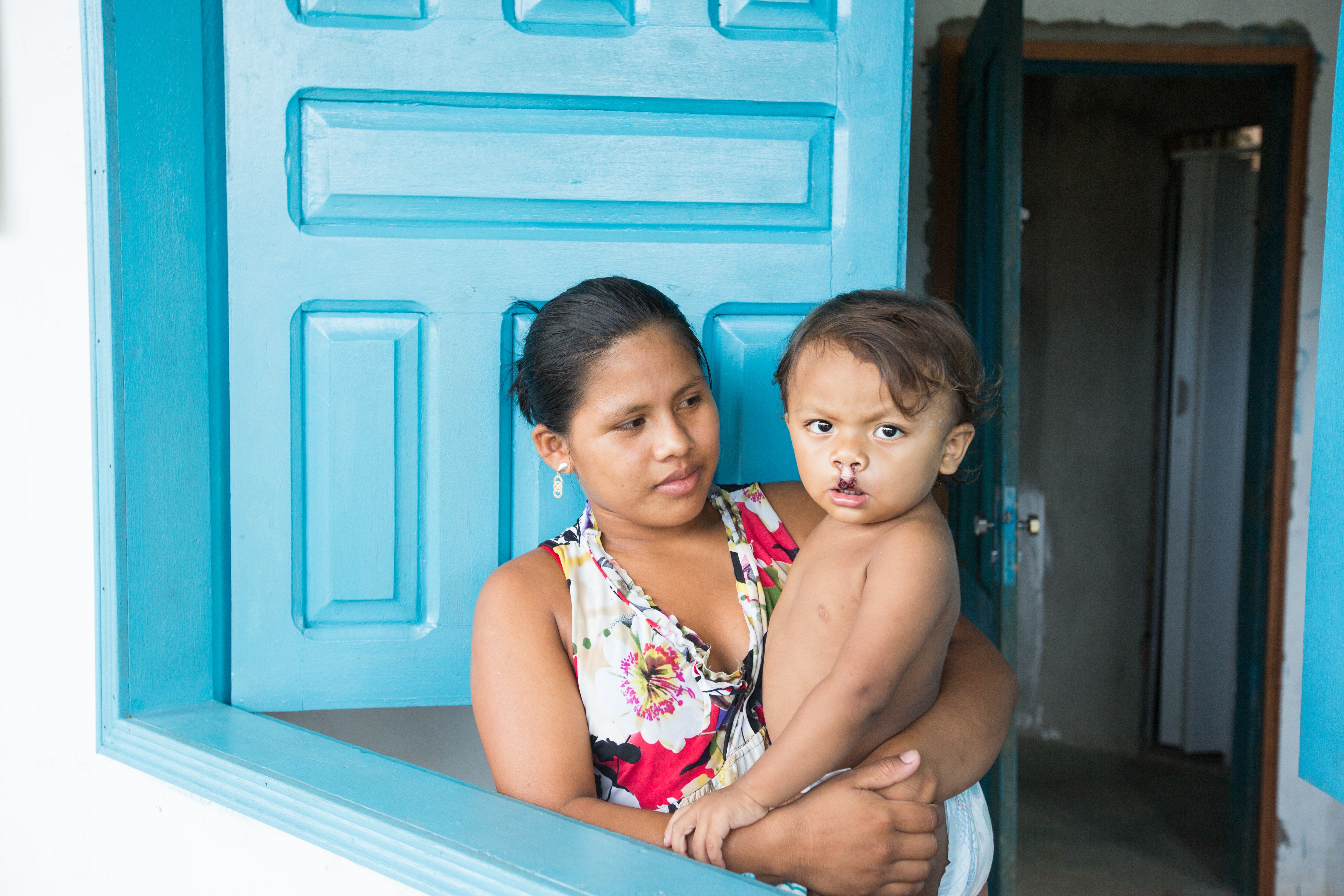 Jeane holding Kalebe after cleft surgery