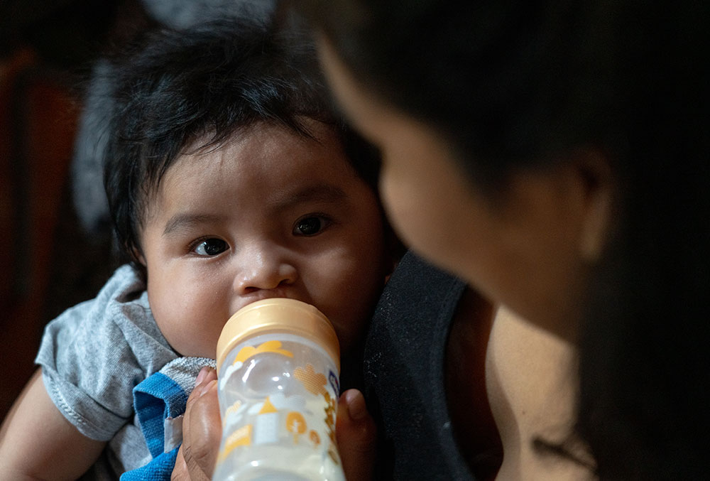 Miguel feeding with a special bottle for babies with clefts