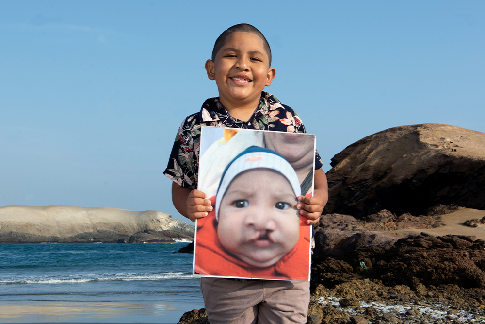 Ramses holding a picture of himself before cleft surgery 