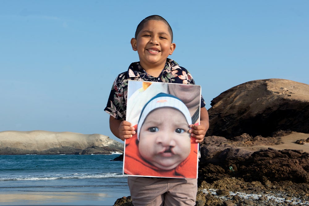 Ramsés segurando uma foto sua antes da cirurgia de fissura