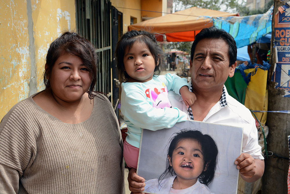 Shaymi smiling with her mother Maria and grandfather and holding a photo of herself before cleft surgery