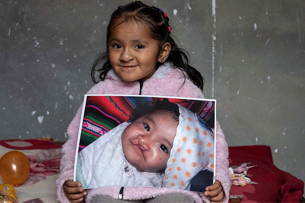 Roselin smiling and holding a picture of herself before cleft surgery