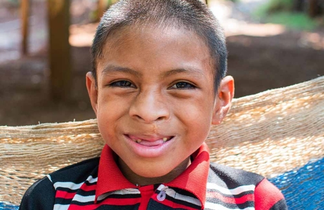 Auner sorrindo depois de uma fenda de trem para sorriso livre e cirurgia labial na Guatemala