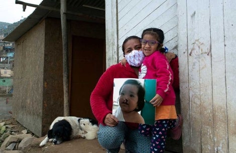 Kristhell and her mother, Cinthya, hold a picture of Kristhell before Smile Train cleft surgery