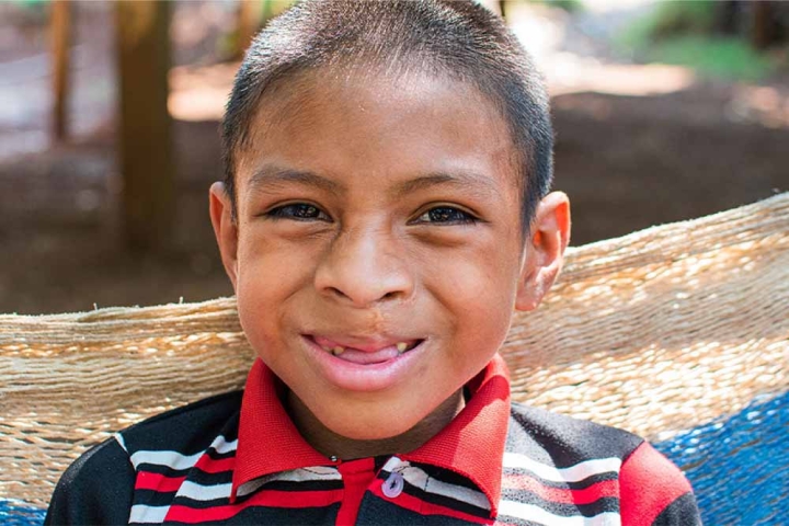 Auner sorrindo depois de uma fenda de trem para sorriso livre e cirurgia labial na Guatemala