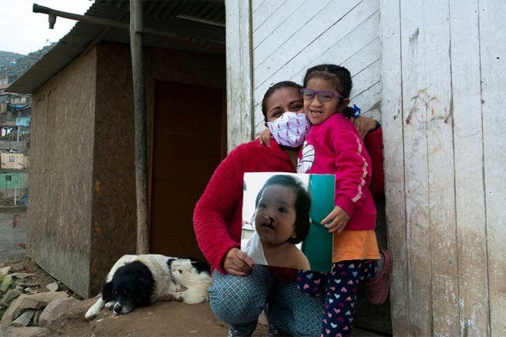 Kristhell and her mother, Cinthya, hold a picture of Kristhell before Smile Train cleft surgery