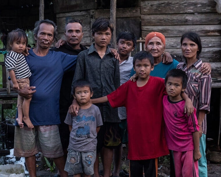 Alim e Rajib sorrindo com sua família antes da cirurgia de fissura labiopalatina